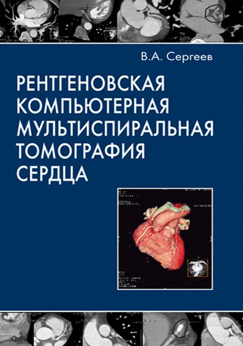 Рентгеновская компьютерная мультиспиральная томография сердца. Сергеев В.А. 2009г.
