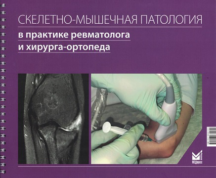 Скелетно-мышечная патология в практике ревматолога и хирурга-ортопеда. Краткое иллюстрированное руководство.  Лила А.М. 2023г.