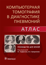 К.Т, в диагностике пневмоний. Атлас. 2021г. Под редакцией Г.Е. Труфанова.