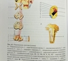 Неврология и нейрохирургия в двух томах. Е.И. Гусев, А.Н. Коновалов, В.И. Скворцова. 2009г. 