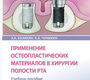 Применение остеопластических материалов в хирургии полости рта. Базикян Э.А., Чунихин А.А.  2023г.