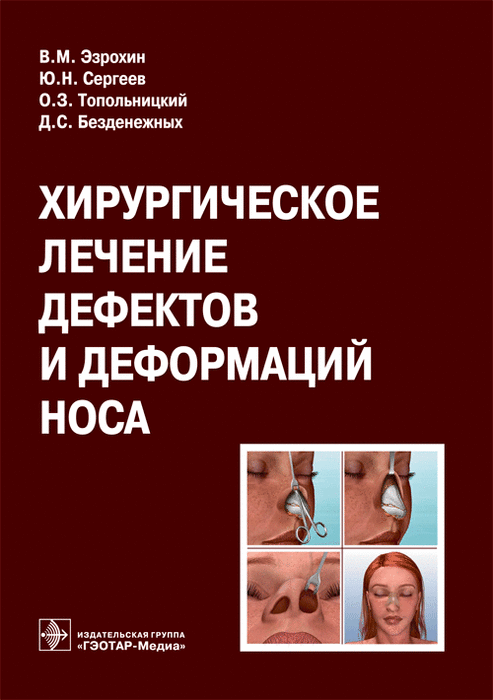 Хирургическое лечение дефектов и деформаций носа. Эзрохин В.М. и др. 2015 г.