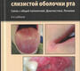 Заболевания слизистой оболочки рта. Цветкова. 2025 г.