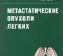 Метастатические опухоли легких.  Трахтенберг А.Х., Чиссов В.И., Паршин В.Д., Пикин О.В.  2009г.