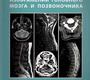 Норма КТ- и MPT-изображений головного мозга и позвоночника. Труфанов Г.Е. 2023г.