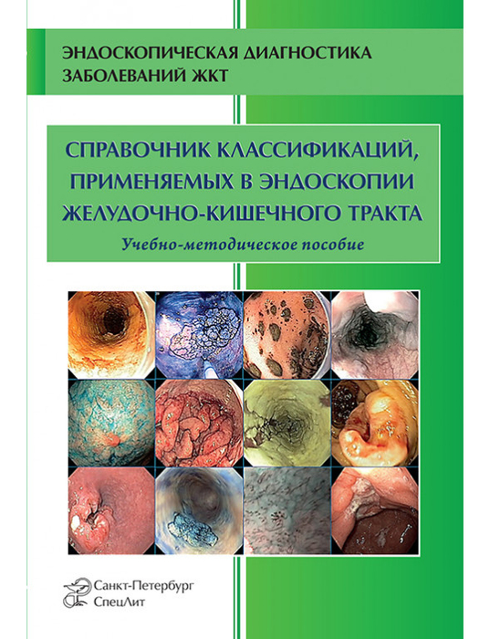 Справочник классификаций, применяемых в эндоскопии желудочно-кишечного тракта.  Кузин М.Н. 2022г.