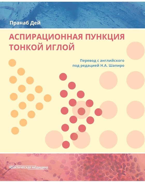 Аспирационная пункция тонкой иглой.  Пранаб Дей. 2020г.