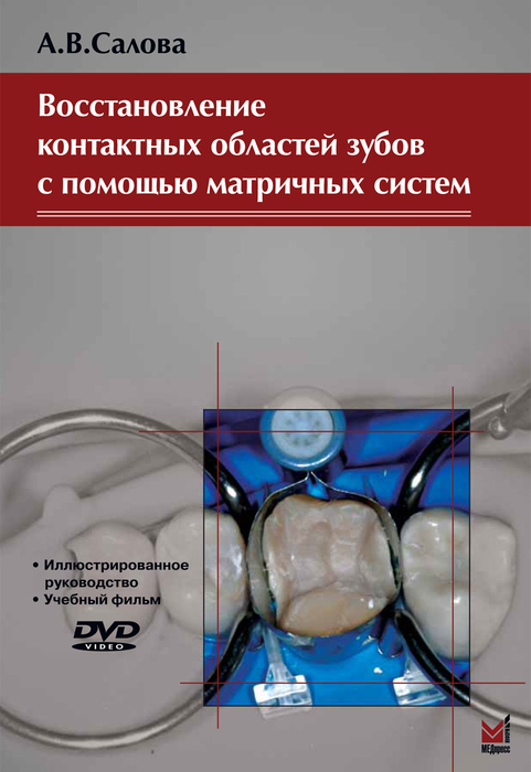 Салова А.В. Восстановление контактных областей зубов с помощью матричных систем+DVD. 2008г.