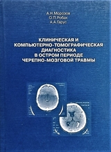 Клиническая и компьютерно-томографическая диагностика в остром периоде черепно-мозговой травмы. 2007г.