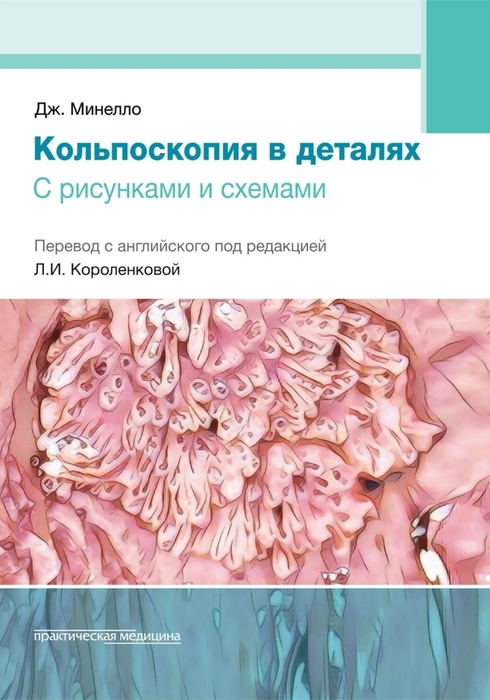 Кольпоскопия в деталях с рисунками и схемами. Минелло Дж.