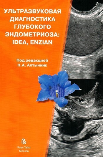  Ультразвуковая диагностика глубокого эндометриоза: IDEA, ENZIAN. Алтынник. 2024г.
