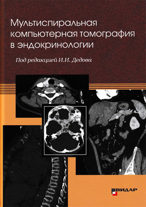 Мультиспиральная компьютерная томография в эндокринологии. Под ред. И.И. Дедова. 2020г.