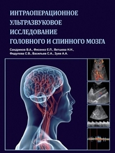 Интраоперационное ультразвуковое исследование головного и спинного мозга. Сандриков В.А. 2012 г.