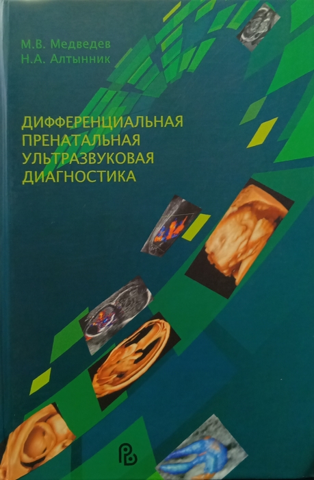 Дифференциальная пренатальная ультразвуковая диагностика. 2025г Медведев, Алтынник