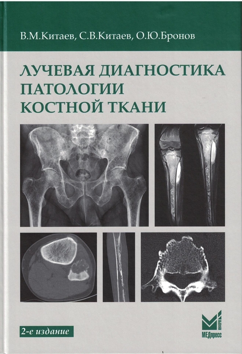 Лучевая диагностика патологии костной ткани. Китаев В.М. 2024 г.