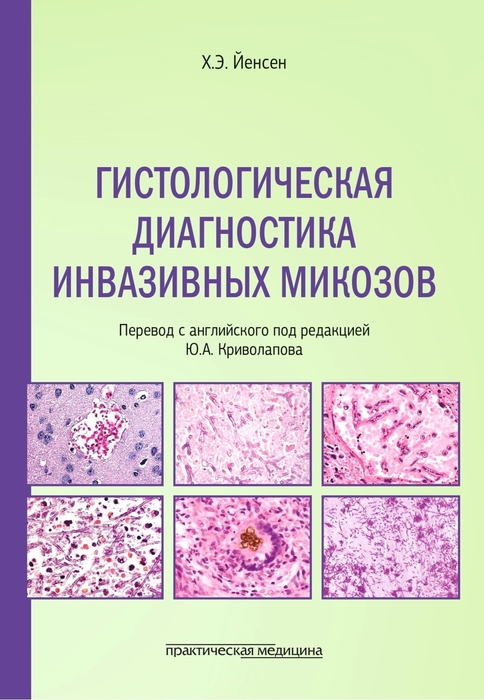 Гистологическая диагностика инвазивных микозов. Йенсен Х.Э. 2025 г