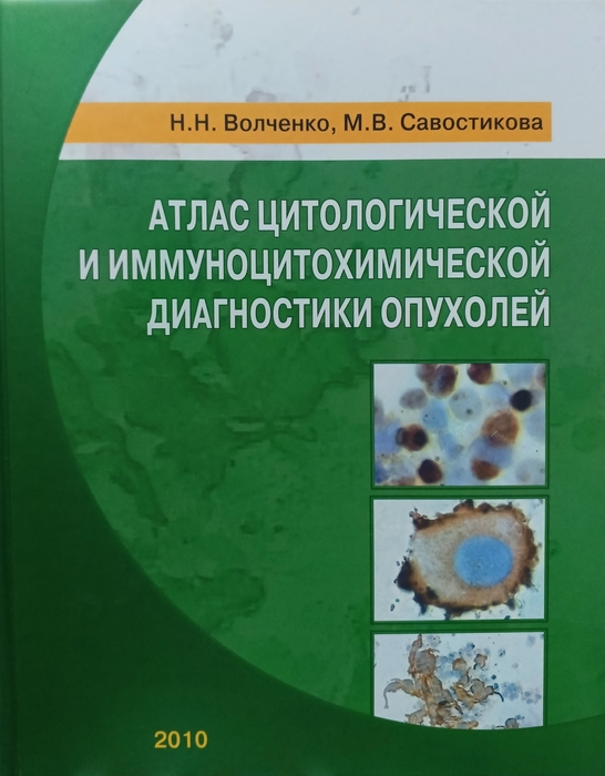 Атлас цитологической и иммуноцитохимической диагностики опухолей. 