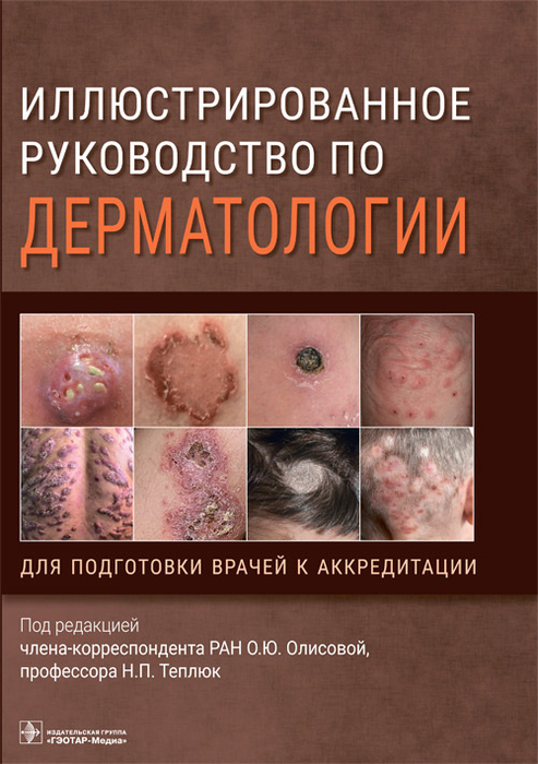 Иллюстрированное руководство по дерматологии. Олисова О.Ю, Теплюк Н.П.