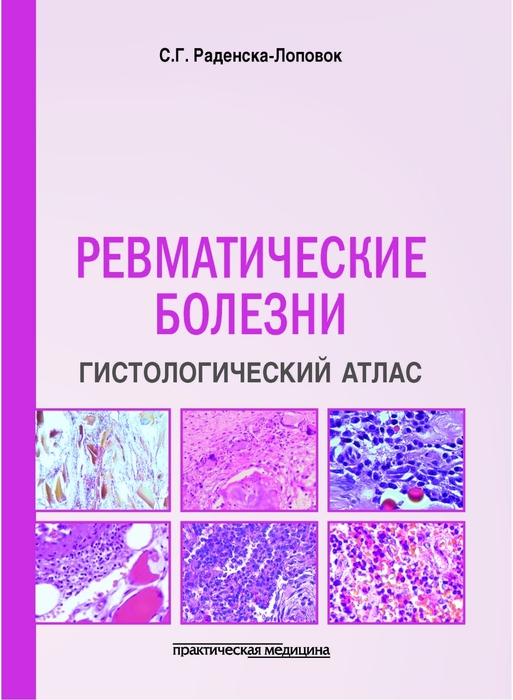 Ревматические болезни. Гистологический атлас. Раденска-Лоповок С.Г. 2025 г