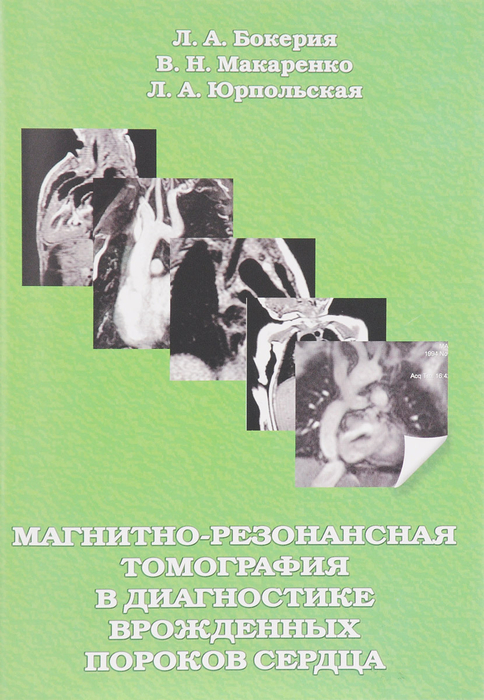 Магнитно-резонансная томография в диагностике врожденных пороков сердца.  Бокерия. Л.А. 2009г.