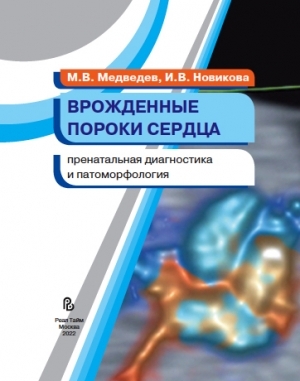 Врожденные пороки сердца. Пренатальная диагностика и патоморфология. Медведев, Новикова