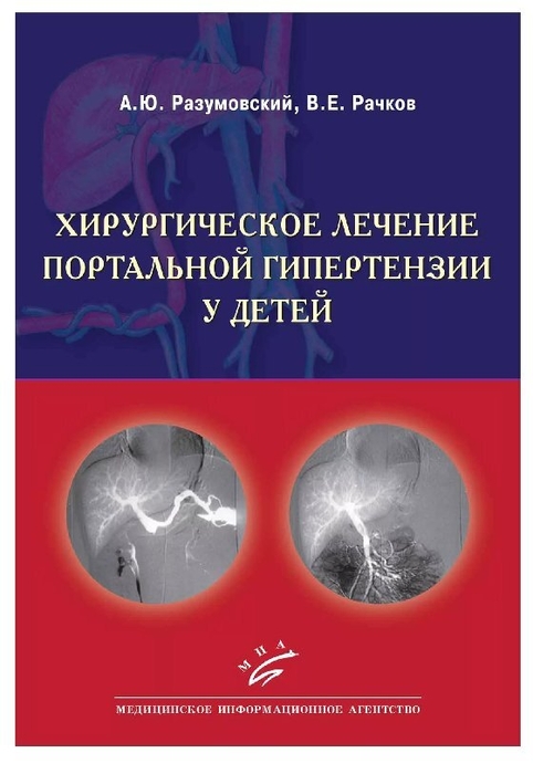 Хирургическое лечение портальной гипертензии у детей.  Разумовский. 2012г.