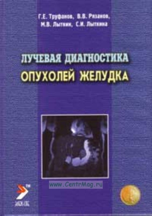 Лучевая диагностика опухолей желудка. Труфанов Г.Е. 2007 г.