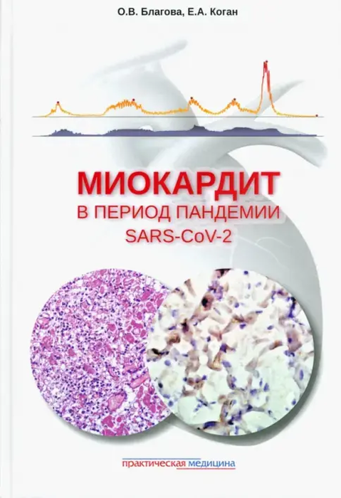 Миокардит в период пандемии SARS-CoV-2. Коган Е.А., Благова О.В. 2023г.