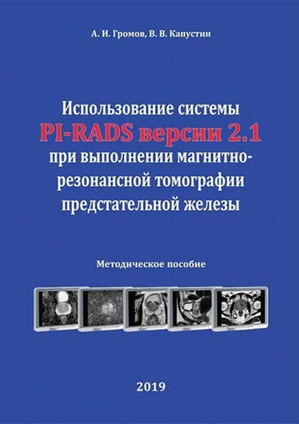 Использование системы PI-RADS версии 2.1 при выполнении магнитно-резонансной томографии предстательной железы. Громов. 2019г.