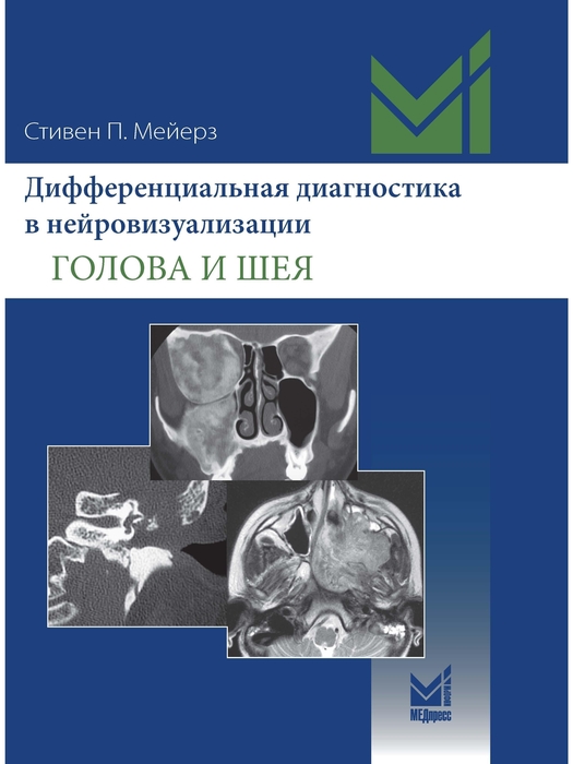 Дифференциальная диагностика в нейровизуализации. Голова и шея. Мейерз С.П. 2023г.