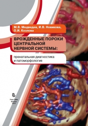 Врожденные пороки центральной нервной системы. Медведев, Новикова 2023г.