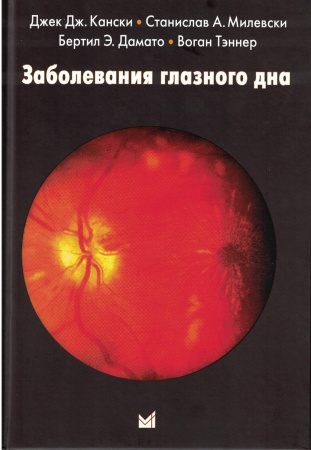 Заболевания глазного дна. Кански. 2024г.