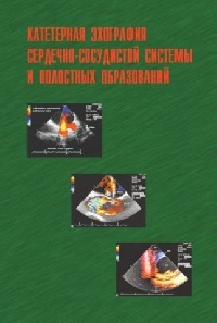 Катетерная эхография сердечно-сосудистой системы и полостных образований + CD.  Сандриков. 2005 г.