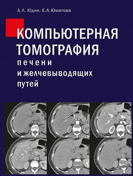 Компьютерная томография печени и желчевыводящих путей. Практическое руководство.  Юдин А.Л., Юматова. Е.А. 2023г.