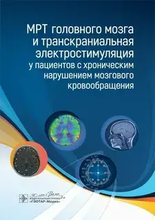 МРТ головного мозга и транскраниальная электростимуляция у пациентов с хроническим нарушением мозгового кровообращения. Морозова, 2024г.