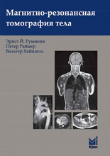 Магнитно-резонансная томография тела Руммени. 2022г.