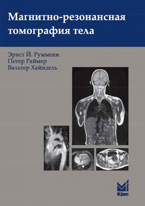 Магнитно-резонансная томография тела Руммени. 2022г.