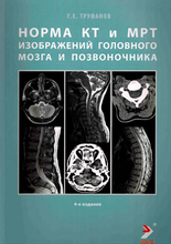 Норма КТ- и MPT-изображений головного мозга и позвоночника. Труфанов Г.Е. 2023г.