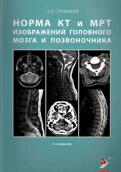 Норма КТ- и MPT-изображений головного мозга и позвоночника. Труфанов Г.Е. 2023г.