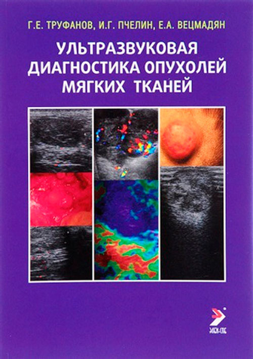 Ультразвуковая диагностика опухолей мягких тканей. Труфанов. 2024г.