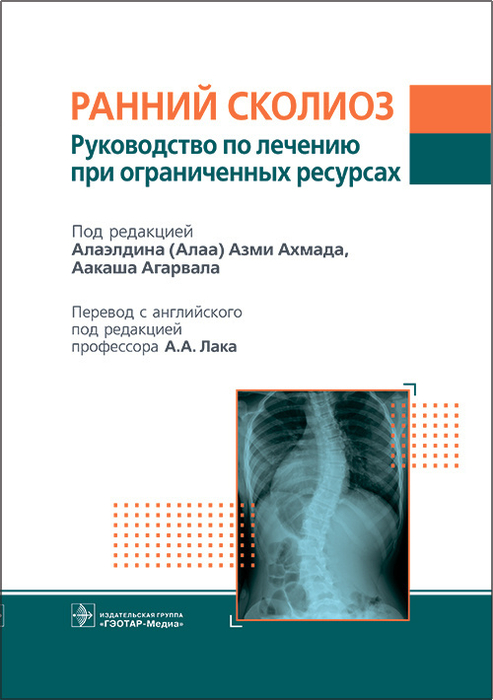 Ранний сколиоз. Руководство по лечению при ограниченных ресурсах. Под ред. А.А. Ахмада, А. Агарвала; Пер. с англ.; Под ред. А.А. Лака. 2023г.