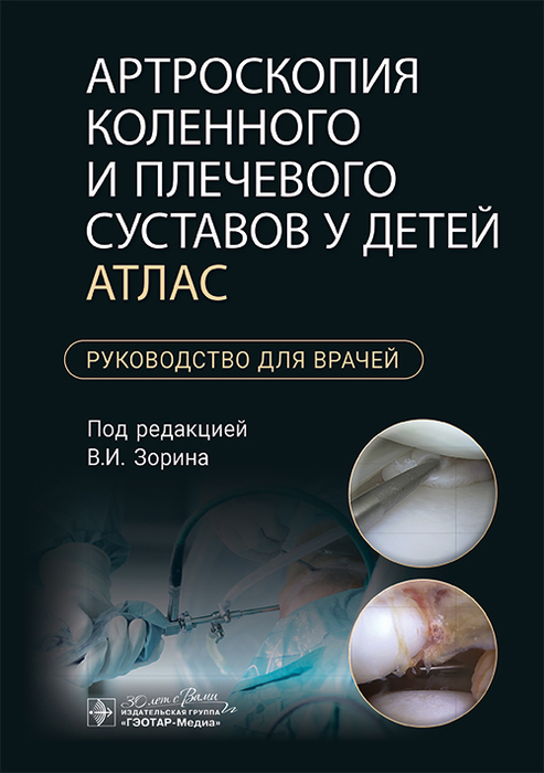 Артроскопия коленного и плечевого суставов у детей. Атлас. Зорин. 2024г.