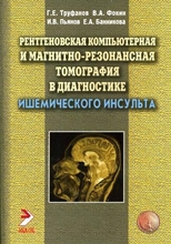 МРТ в диагностике ишемического инсульта. Фокин. 2012г.
