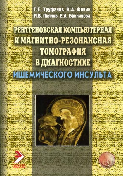 МРТ в диагностике ишемического инсульта. Фокин. 2012г.
