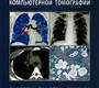 Заключения в торакальной компьютерной томографии. Сперанская.  2024г.