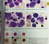 Гематологический атлас. Луговская. 2023г.