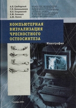 Компьютерная визуализация чрескостного остеосинтеза. Монография. Слободской. А.Б. 2004г.