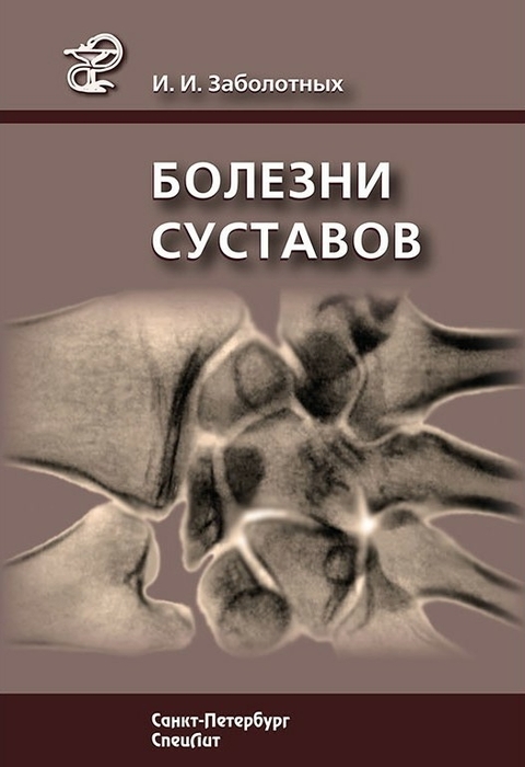 Болезни суставов. Руководство. 3-е издание. Заболотных И.И. 2013 г.