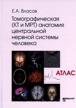 Томографическая (КТ и МРТ) анатомия центральной нервной системы человека. Атлас. Е.А. Власов. 2020г
