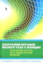 Эхография органов малого таза у женщин. Пограничные опухоли, рак и редкие опухоли яичников - Демидов В.Н. 2017г. Эхография органов малого таза у женщин. Пограничные опухоли, рак и редкие опухоли яичников - Демидов В.Н. 2017г.